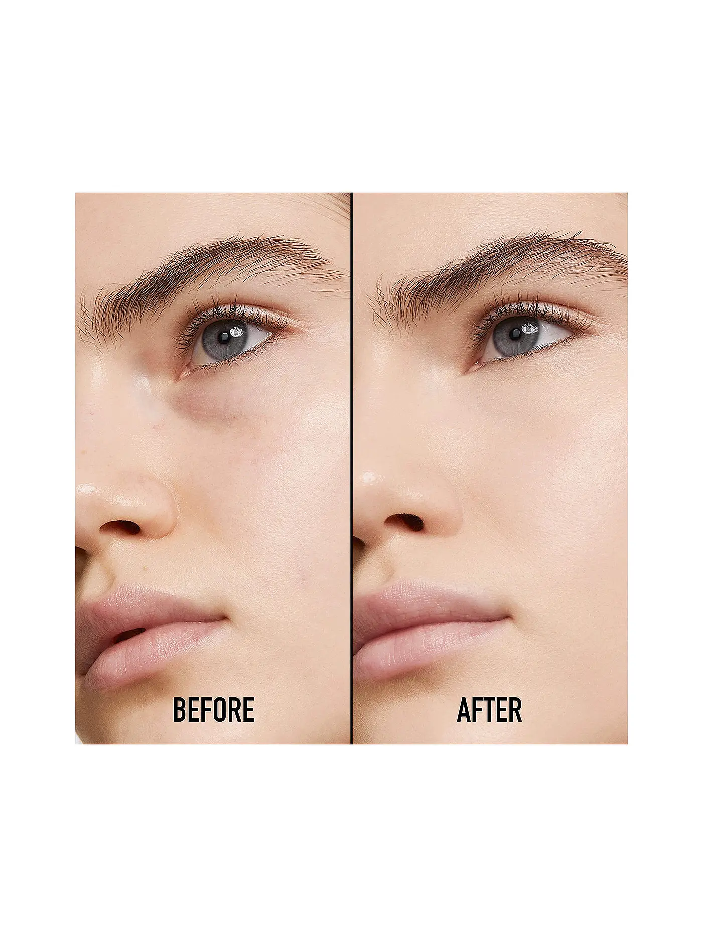 DIOR | Concealer - Dior Forever Skin Correct ( 2 N Neutral ) | beige